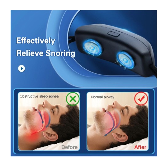 EMS Pulse Stop Snore Portable Comfortable Sleep Well Stop Snore Health Care Sleep Apnea Aid USB Smart Anti Snoring Device